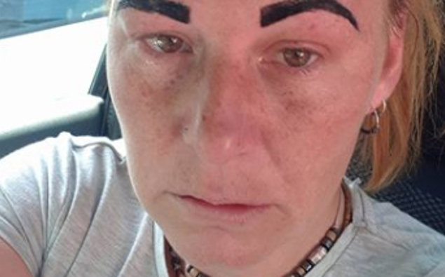 Woman Left With Angry Bird Eyebrows After Botched Beauty Treatment